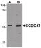 Coiled-Coil Domain Containing 47 antibody, PA5-20855, Invitrogen Antibodies, Western Blot image 