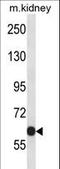 Potassium Voltage-Gated Channel Subfamily C Member 2 antibody, LS-C165413, Lifespan Biosciences, Western Blot image 