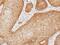 CG1 antibody, PA5-29523, Invitrogen Antibodies, Immunohistochemistry frozen image 