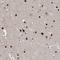 TSPY Like 1 antibody, HPA031970, Atlas Antibodies, Immunohistochemistry paraffin image 