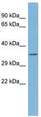 ER Membrane Protein Complex Subunit 2 antibody, TA346617, Origene, Western Blot image 