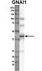 G Protein Subunit Alpha I1 antibody, TA335036, Origene, Western Blot image 