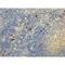 IgG4 antibody, NBP2-62126, Novus Biologicals, Immunohistochemistry paraffin image 