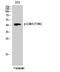 Cyclin Dependent Kinase 9 antibody, P00794, Boster Biological Technology, Western Blot image 