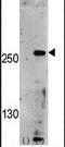 Phosphoinositide Kinase, FYVE-Type Zinc Finger Containing antibody, PA5-13977, Invitrogen Antibodies, Western Blot image 