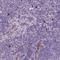 Netrin G2 antibody, NBP2-49653, Novus Biologicals, Immunohistochemistry paraffin image 