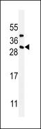 CD8b Molecule antibody, LS-C168572, Lifespan Biosciences, Western Blot image 