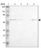 Zinc Finger Protein 550 antibody, NBP1-86158, Novus Biologicals, Western Blot image 