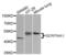 Alpha-1-antitrypsin antibody, LS-C331209, Lifespan Biosciences, Western Blot image 