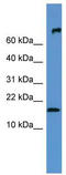 Heparin-binding growth factor 1 antibody, TA336219, Origene, Western Blot image 