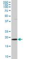 S-Phase Kinase Associated Protein 1 antibody, H00006500-M03, Novus Biologicals, Western Blot image 