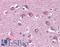 Calcium/Calmodulin Dependent Protein Kinase II Beta antibody, LS-B4292, Lifespan Biosciences, Immunohistochemistry paraffin image 