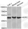 Golgi Associated PDZ And Coiled-Coil Motif Containing antibody, A4887, ABclonal Technology, Western Blot image 