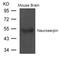 Serpin Family I Member 1 antibody, 79-721, ProSci, Western Blot image 