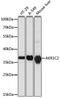 Aldo-Keto Reductase Family 1 Member C2 antibody, A1048, ABclonal Technology, Western Blot image 