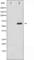 Checkpoint Kinase 2 antibody, abx010984, Abbexa, Western Blot image 