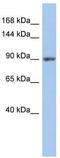Mitogen-Activated Protein Kinase Kinase Kinase Kinase 5 antibody, TA332033, Origene, Western Blot image 