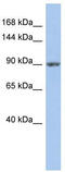 Mitogen-Activated Protein Kinase Kinase Kinase Kinase 5 antibody, TA332033, Origene, Western Blot image 