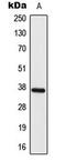 Elongation of very long chain fatty acids protein 4 antibody, GTX55225, GeneTex, Western Blot image 