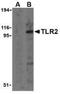 Toll Like Receptor 2 antibody, NBP1-77229, Novus Biologicals, Western Blot image 