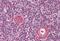 Mitochondrial Antiviral Signaling Protein antibody, MBS240298, MyBioSource, Immunohistochemistry paraffin image 