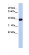 Neuronal Differentiation 4 antibody, orb324419, Biorbyt, Western Blot image 