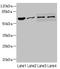 NADPH Oxidase 3 antibody, LS-C682131, Lifespan Biosciences, Western Blot image 