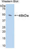 Glutamic-Oxaloacetic Transaminase 1 antibody, LS-C292944, Lifespan Biosciences, Western Blot image 