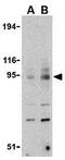 Toll Like Receptor 9 antibody, GTX31294, GeneTex, Western Blot image 