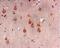 Mitogen-Activated Protein Kinase Kinase Kinase 7 antibody, ab109526, Abcam, Immunohistochemistry paraffin image 