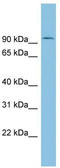 Tousled Like Kinase 1 antibody, TA344373, Origene, Western Blot image 