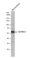 Katanin Catalytic Subunit A1 Like 1 antibody, NBP2-17021, Novus Biologicals, Western Blot image 