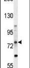 ATP Binding Cassette Subfamily D Member 1 antibody, PA5-23957, Invitrogen Antibodies, Western Blot image 