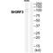 SH3 Domain Containing Ring Finger 3 antibody, A14100, Boster Biological Technology, Western Blot image 