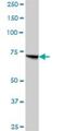 Propionyl-CoA Carboxylase Subunit Alpha antibody, H00005095-B01P, Novus Biologicals, Western Blot image 