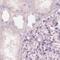 Keratin, type II cuticular Hb2 antibody, PA5-63605, Invitrogen Antibodies, Immunohistochemistry paraffin image 