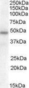 Serpin Family A Member 12 antibody, GTX88737, GeneTex, Western Blot image 
