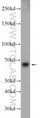 Beta-1,4-N-Acetyl-Galactosaminyltransferase 2 antibody, 24024-1-AP, Proteintech Group, Western Blot image 