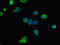 Ataxin 2 antibody, orb46523, Biorbyt, Immunocytochemistry image 