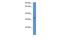 Jumonji Domain Containing 8 antibody, GTX49113, GeneTex, Western Blot image 