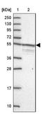 Tripartite Motif-Containing 51 antibody, NBP2-13375, Novus Biologicals, Western Blot image 