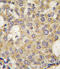 Poly(ADP-Ribose) Glycohydrolase antibody, LS-C100859, Lifespan Biosciences, Immunohistochemistry frozen image 