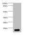 Parvalbumin antibody, A57009-100, Epigentek, Western Blot image 