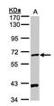 Pantothenate kinase 1 antibody, GTX105920, GeneTex, Western Blot image 