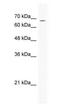 Gamma-aminobutyric acid receptor subunit delta antibody, PA1-24279, Invitrogen Antibodies, Western Blot image 