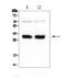 HLA class II histocompatibility antigen, DRB1-15 beta chain antibody, A00568, Boster Biological Technology, Western Blot image 