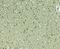 Solute Carrier Family 29 Member 4 antibody, PA5-72853, Invitrogen Antibodies, Immunohistochemistry paraffin image 