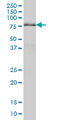 AT-Rich Interaction Domain 3A antibody, LS-B5399, Lifespan Biosciences, Western Blot image 