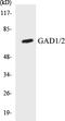 Glutamate Decarboxylase 1 antibody, EKC1232, Boster Biological Technology, Western Blot image 