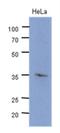 Cyclin Dependent Kinase 4 antibody, NBP2-42642, Novus Biologicals, Western Blot image 